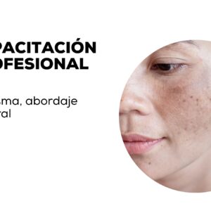 <strong>MELASMA ABORDAJE INTEGRAL</strong>